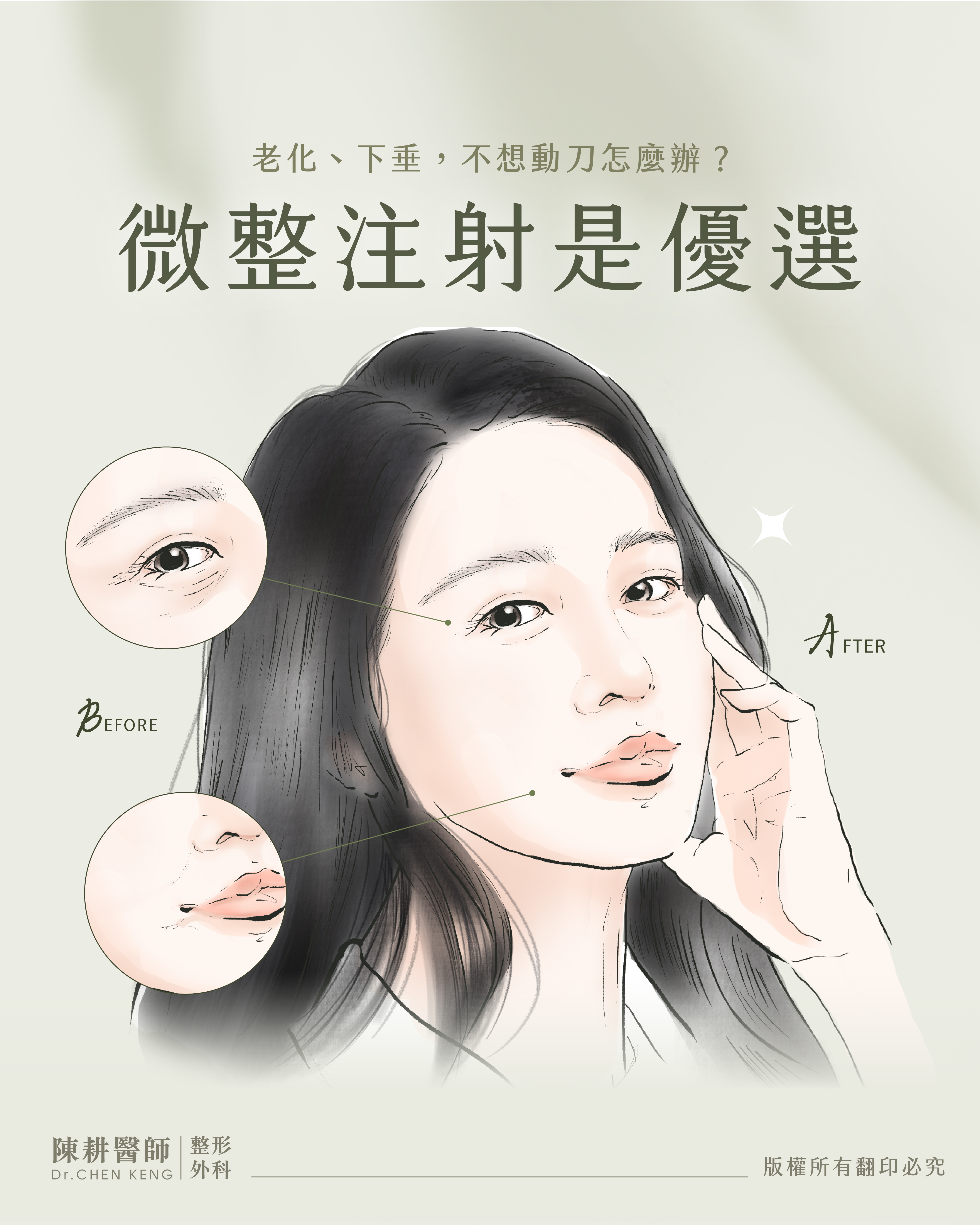 微整注射：不動刀，也讓人一眼驚艷