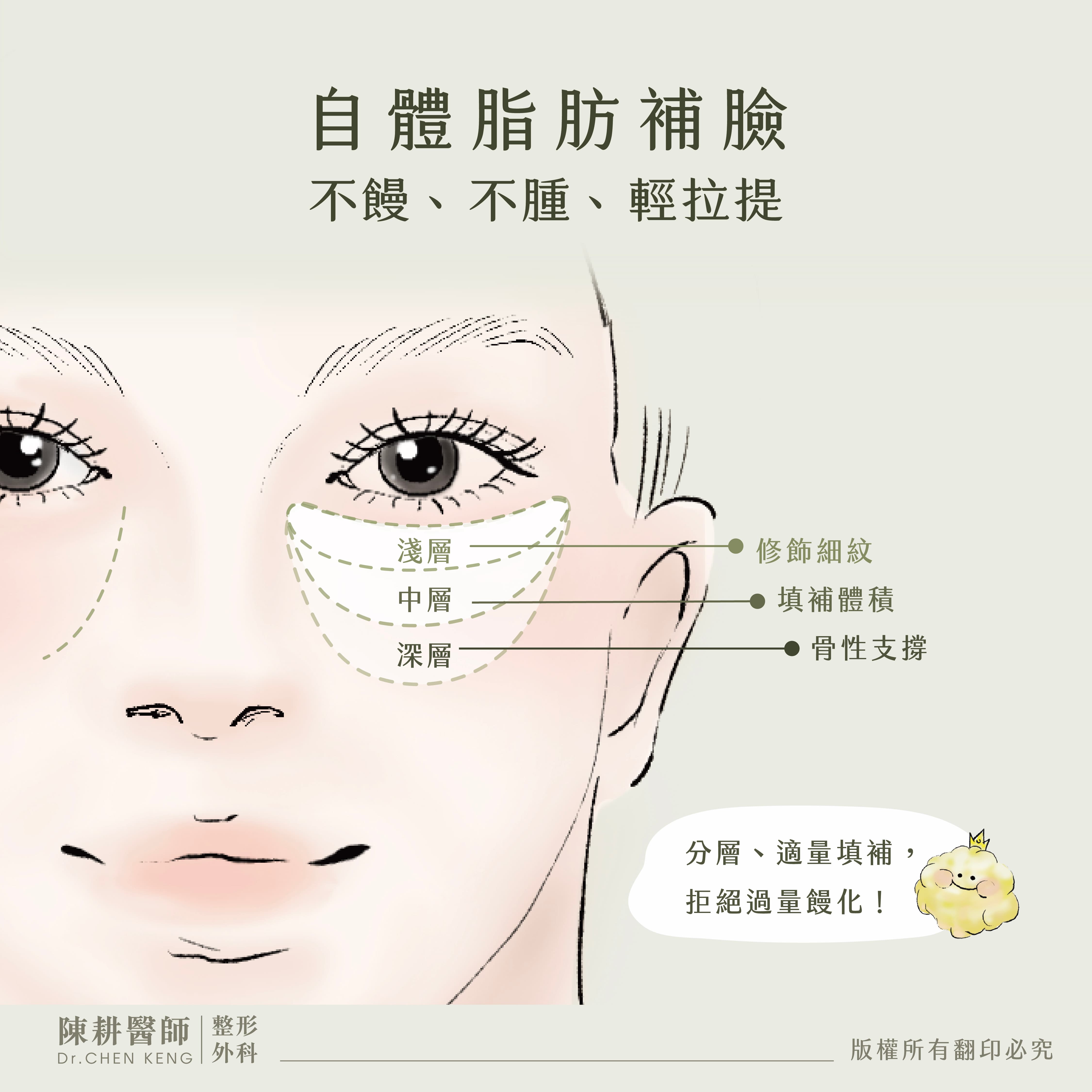 自體脂肪蘋果肌下垂