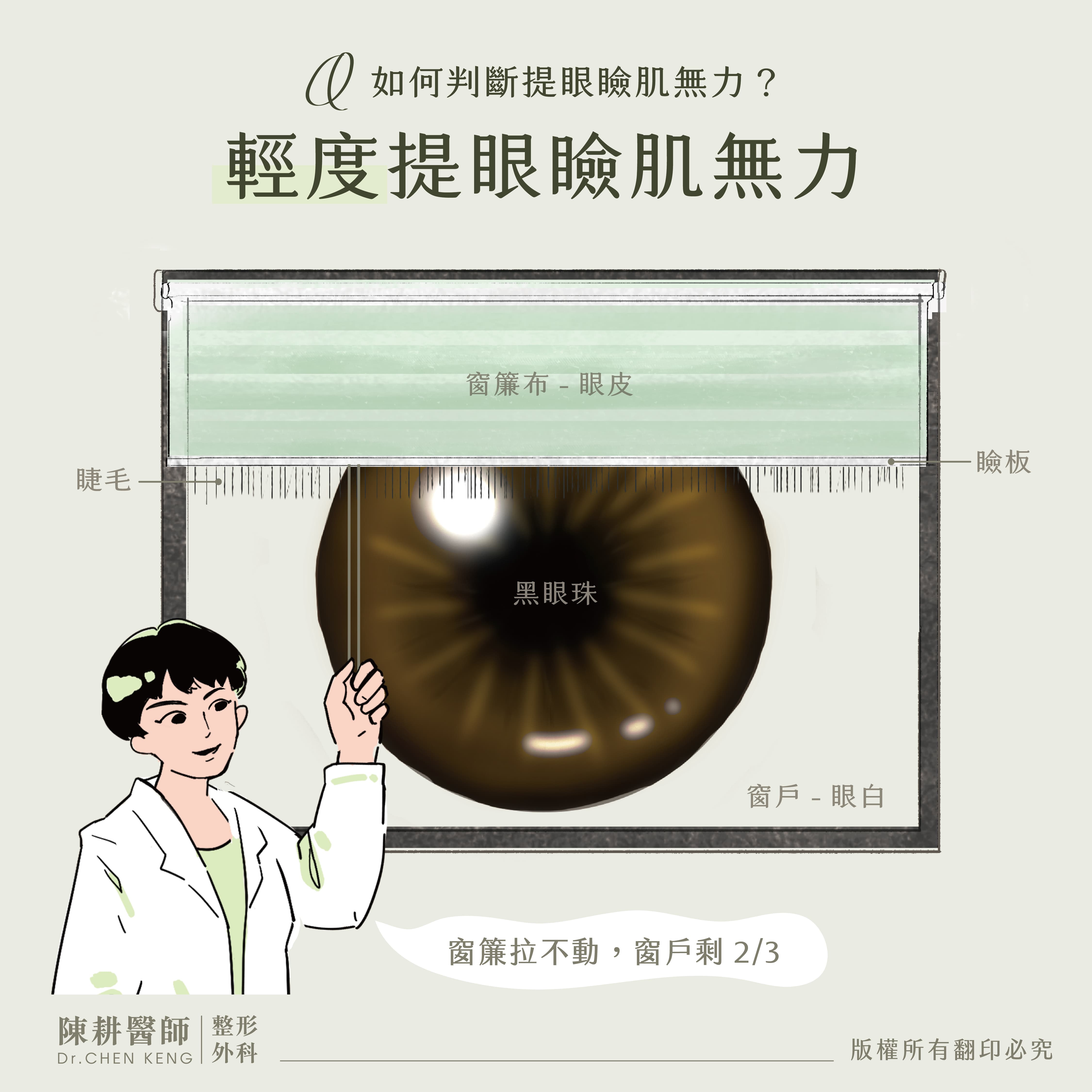 提眼瞼肌症狀-2