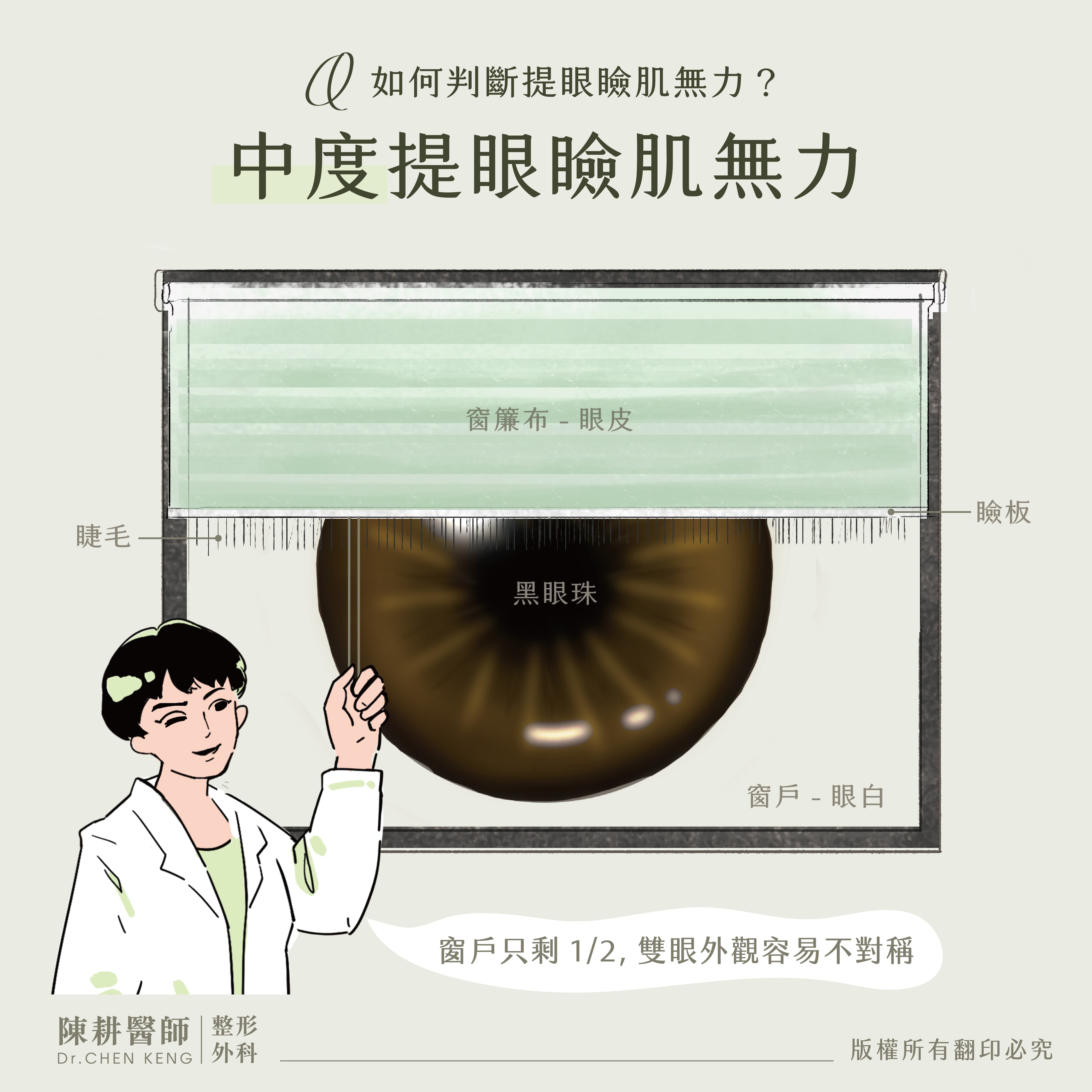 提眼瞼肌症狀-3